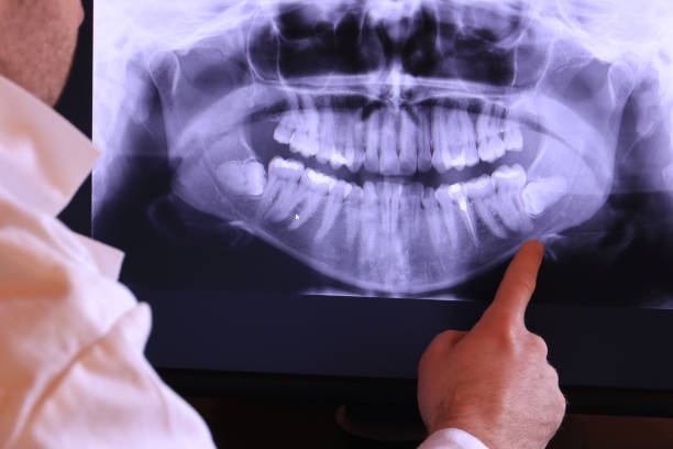 Best Urgent Dental Care for Toothaches in Toquerville, UT